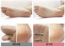 Charger l&#39;image dans la galerie, [Holika Holika] Baby Silky Foot One Shot Peeling
