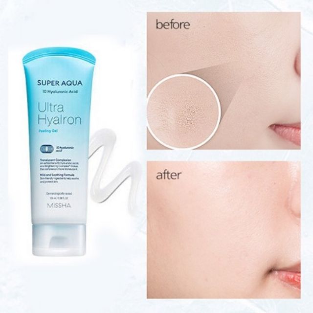 [Missha] Super Aqua Ultra Hyalron Exfoliating Gel